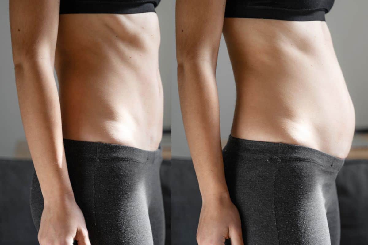 How long does diastasis recti take to improve Shepperton?