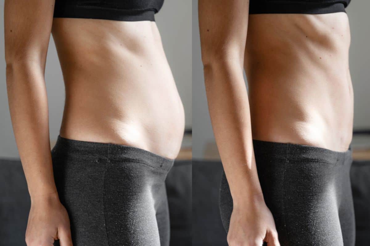 Post-Pregnancy: What Happens to Your Abdominal Muscles After Birth Shepperton