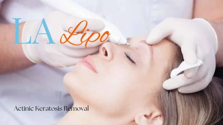 Woman receiving Actinic Keratosis Removal Treatment Shepperton
