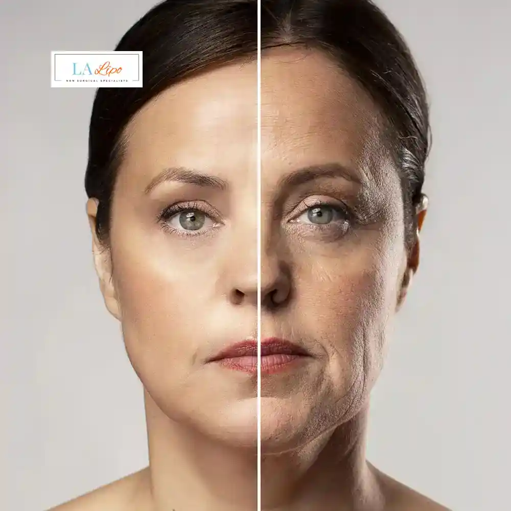 How Can You Tell If Non-Surgical Skin Tightening Is Right for You Shepperton?