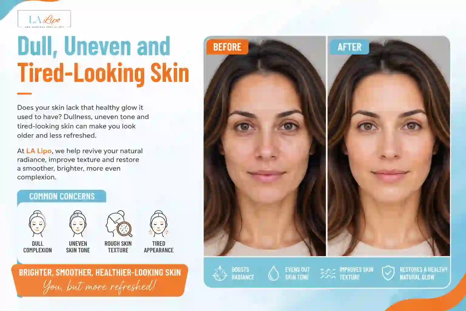 Sign #5: Dull, Uneven and Tired-Looking Skin Shepperton