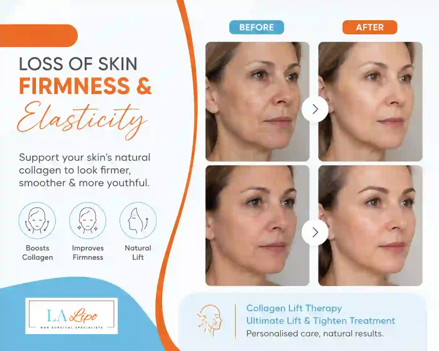 Sign #7: Loss of Skin Firmness and Elasticity Shepperton